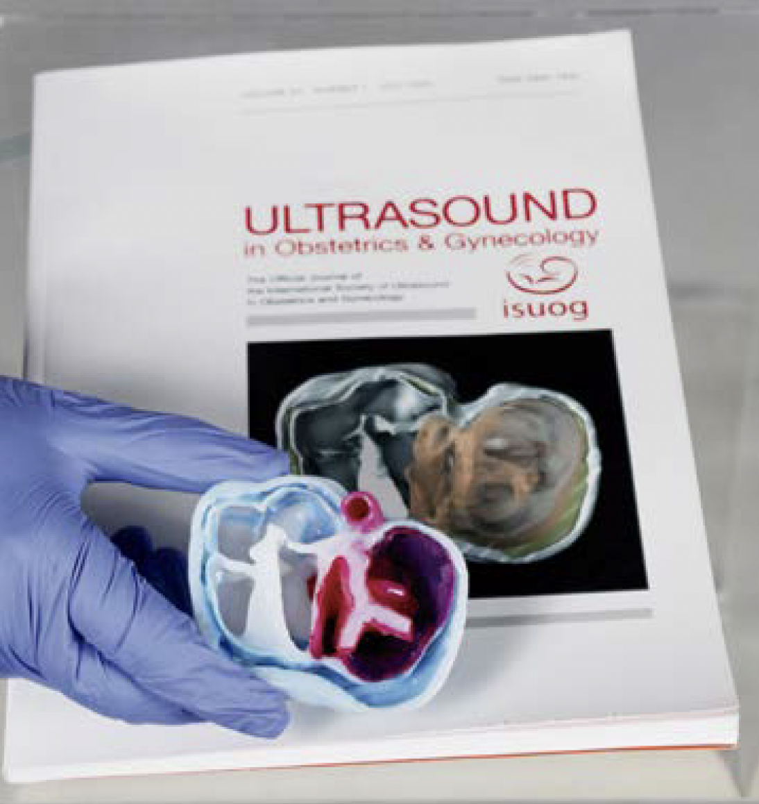 FETAL HEART: from 3D reconstructions and physical models to the metaverse