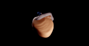 Fetal Heart (videos)