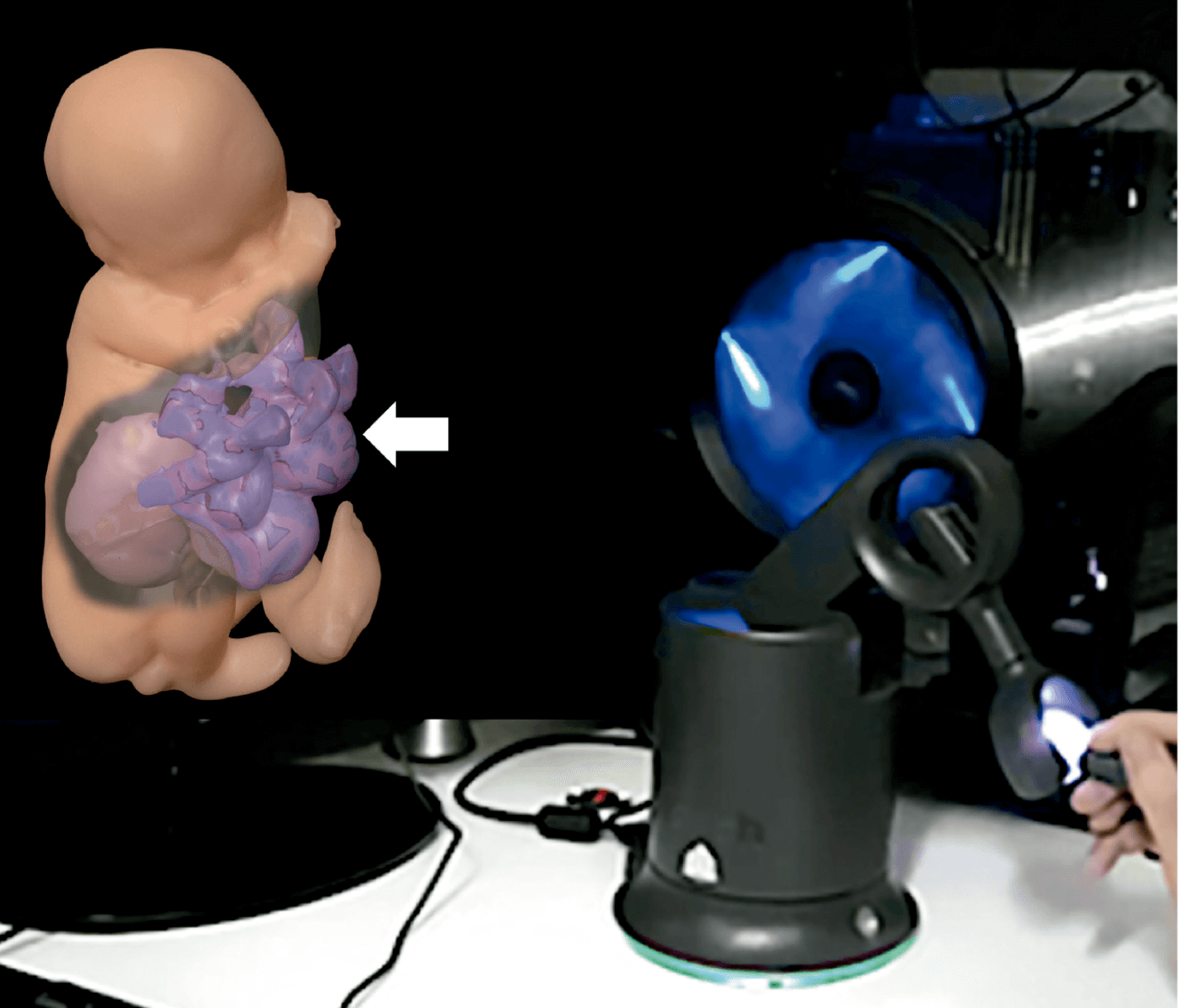 Haptics / Force Feedback Technologies in Fetal Medicine