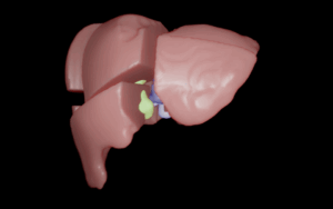 From virtual planning to real incision