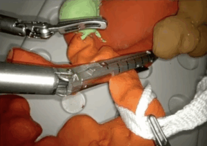 Preoperative surgical training