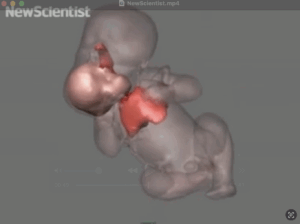 Intro – Medicine