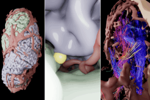 Postnatal Surgery